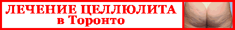 Лечение целлюлита в Торонто
