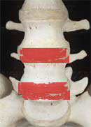 Ћечение болей в спине в “оронто